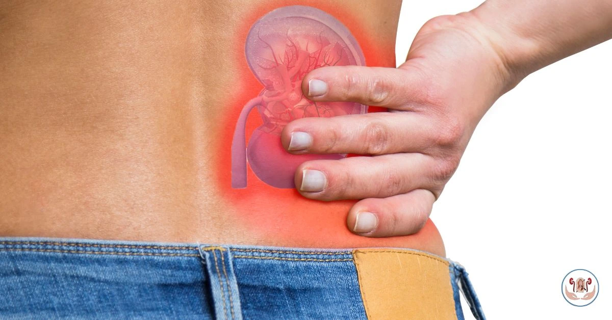 Prevent Kidney Stones Naturally: Simple Habits for Healthy Kidneys