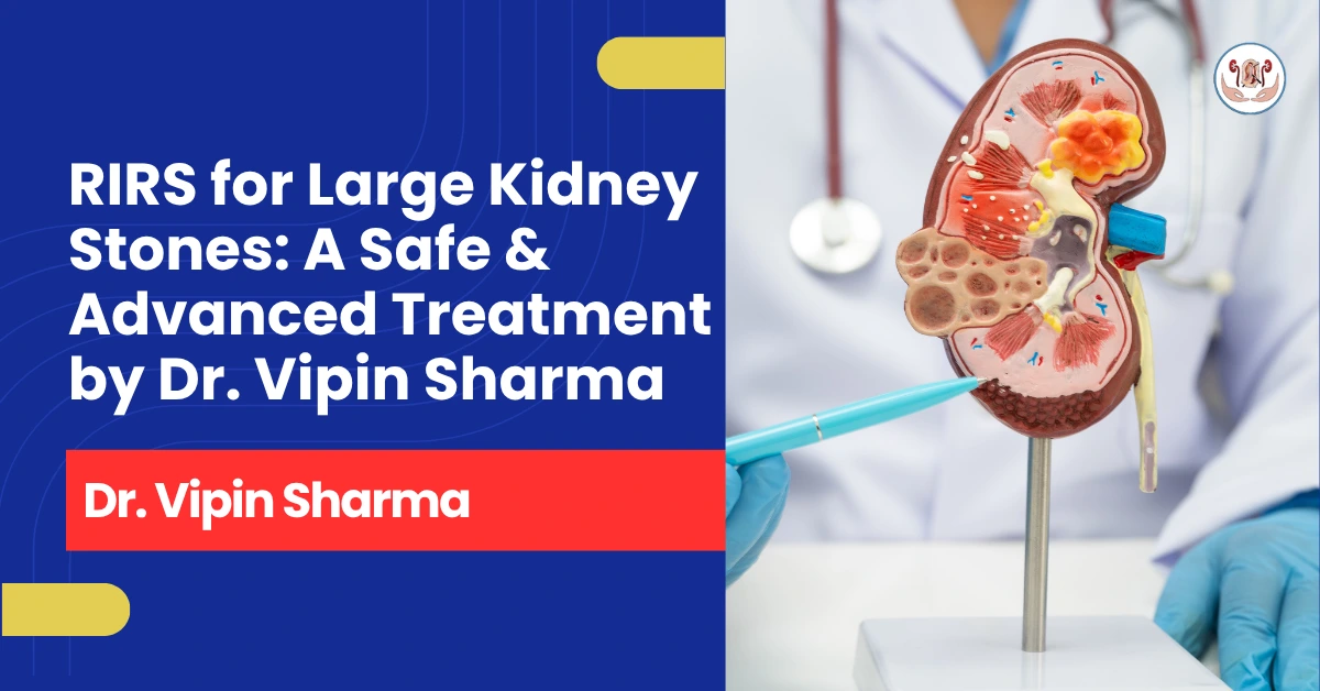 RIRS for Large Kidney Stones: A Safe & Advanced Treatment by Dr. Vipin Sharma