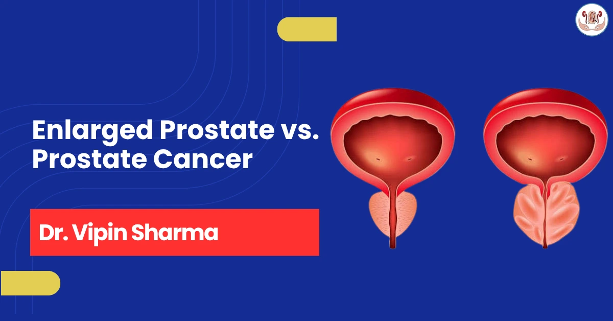 Enlarged Prostate vs. Prostate Cancer 