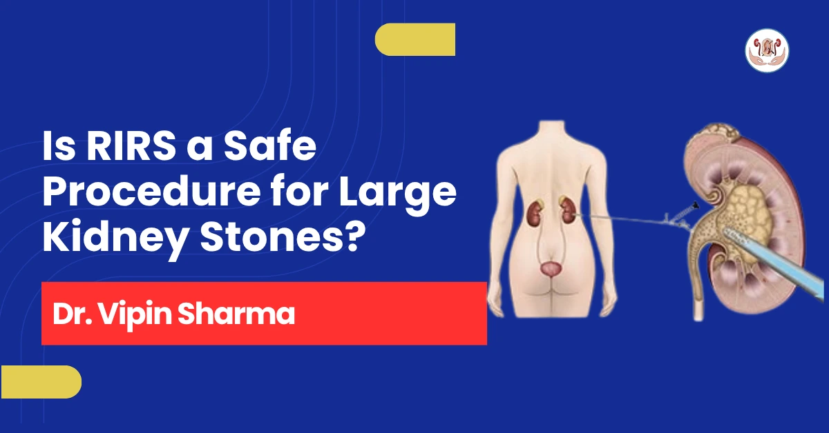 Is RIRS a Safe Procedure for Large Kidney Stones? Expert Insights by Dr. Vipin Sharma, Best Kidney Stone Doctor in Indore